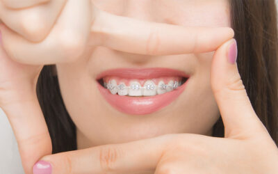 Murrieta’s Best Orthodontic Technology and How We Use It to Perfect Your Smile